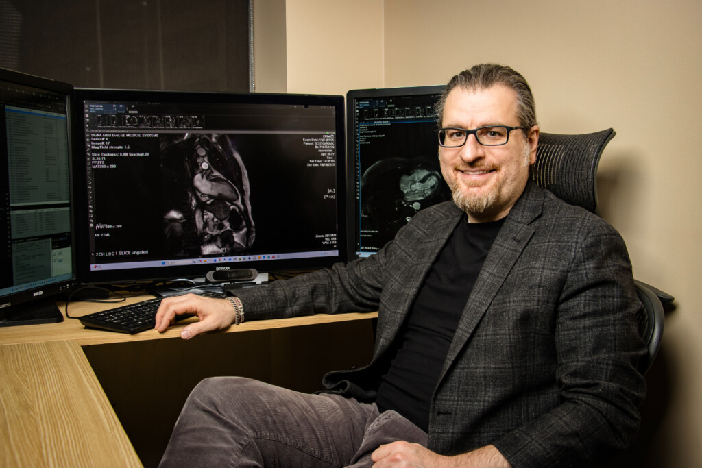 Echocardiogram for Active People: What You Should Know About Your Heart Health